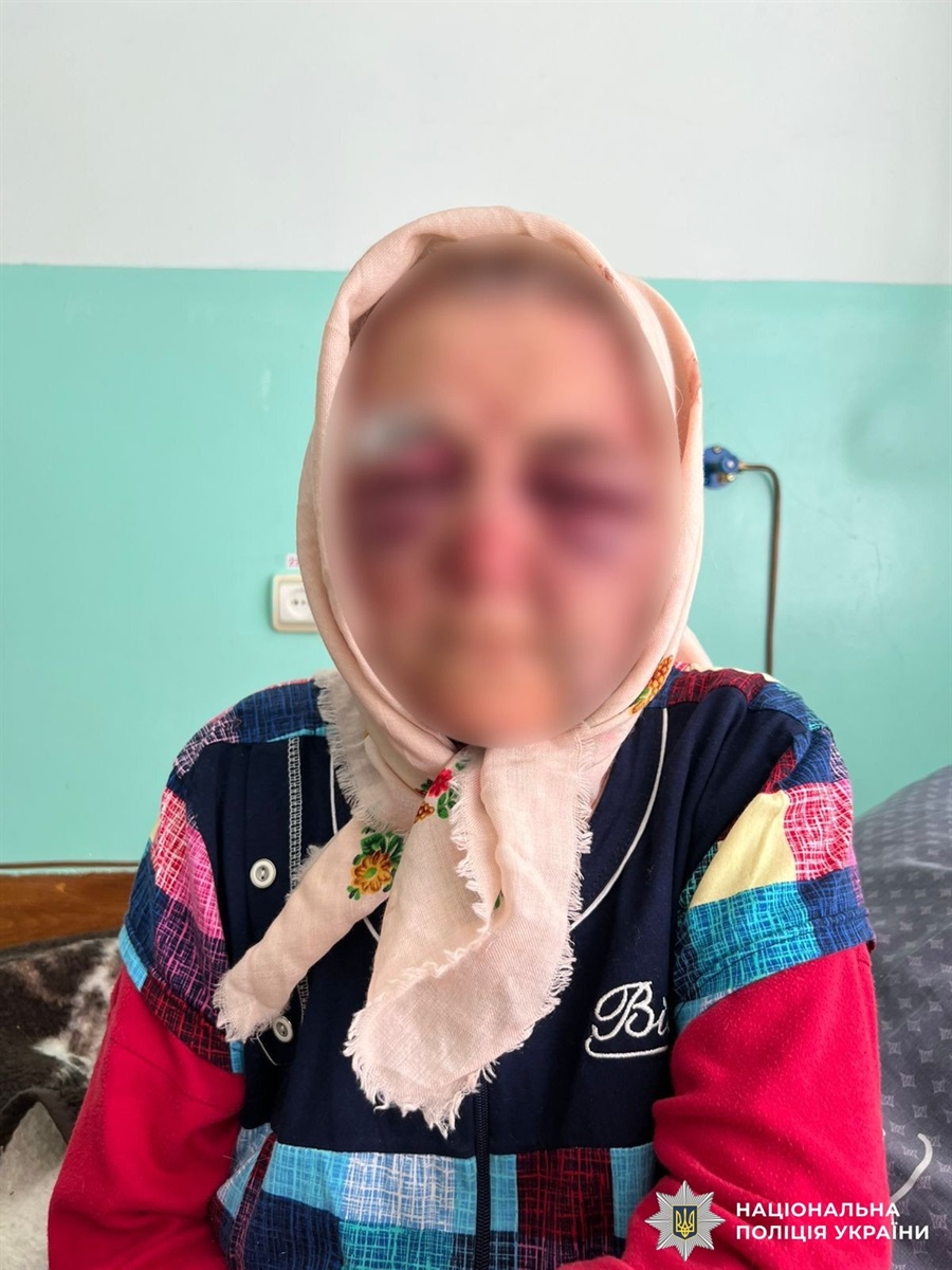 Вісім років позбавлення волі за побиття та пограбування 87-річної жительки Жмеринського району
